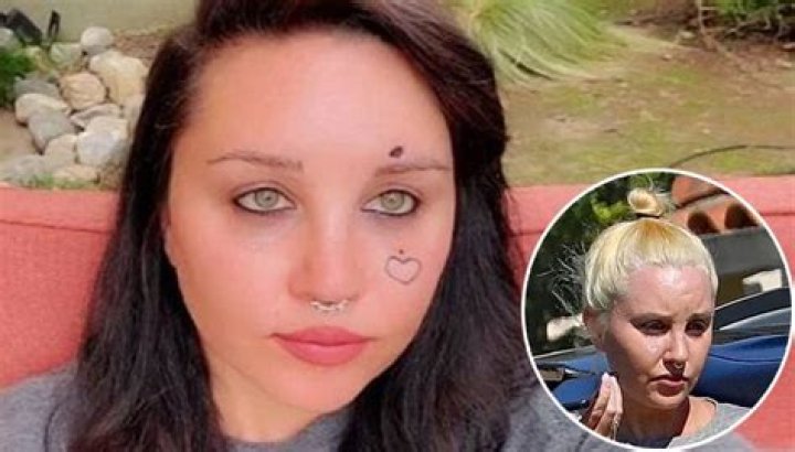‘Heart No More’ Amanda Bynes Face Tattoo Removal and Update, Where Is She Now 2022?