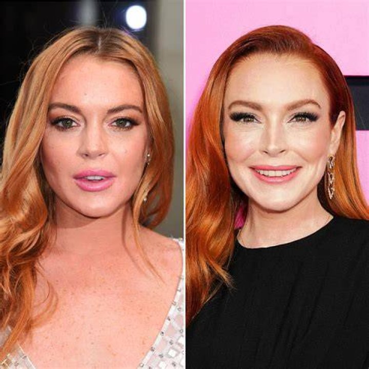 
Lindsey Married At First Sight Plastic Surgery | Before And After Photos 