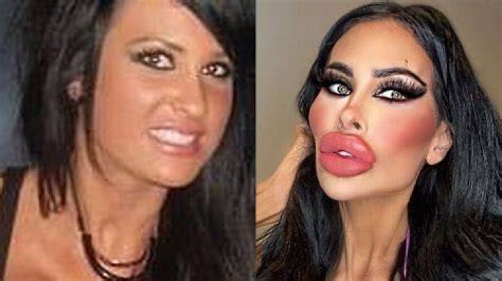 
Tara Jayne Mcconachy Before And After Surgey- Botched Star Sighted In Melbourne 