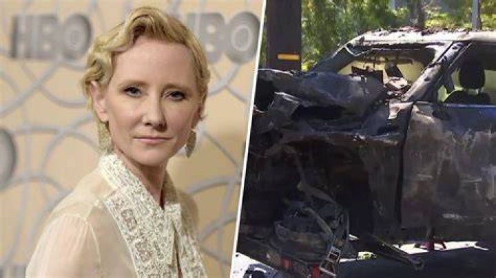 
What exactly are thermal wounds? Days after a catastrophic vehicle crash, Anne Heche’s cause of death was made public. 