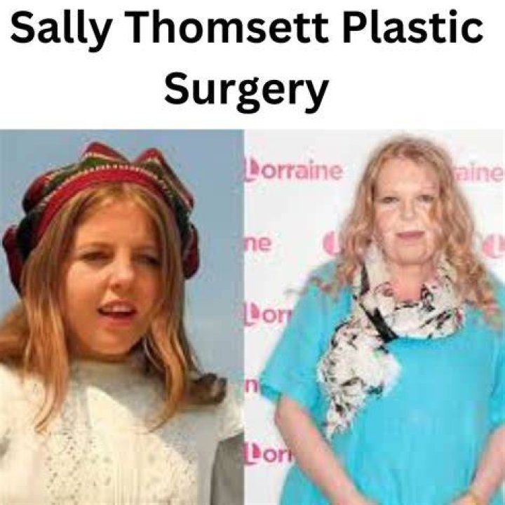 
What Type Of Illness Does Sally Thomsett Have? Face Surgery And Transformation Facts Here 