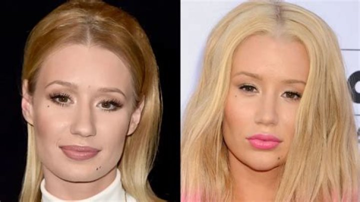 
Why Iggy Azalea Quits Music? Is Iggy Azalea Albino? 